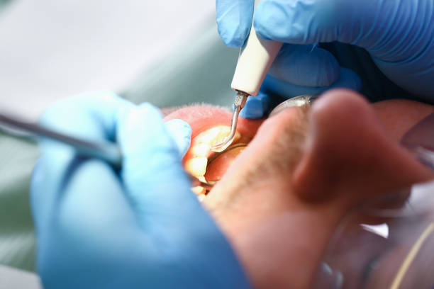 Best Emergency Root Canal Therapy in Grant Park, IL